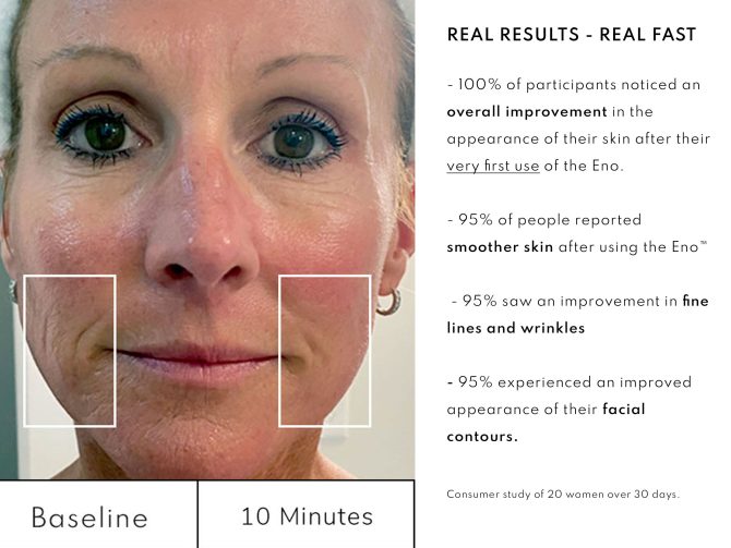 Eno Sensitive Skin Facial Kit. A complete skincare solution for sensitive skin that includes the Patented Eno Facial Device - Image 10