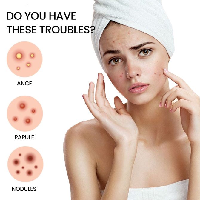 Jaysuing Star Colored Acne Stickers Repair Acne Pits & Marks Fade Acne Spots Blemishes Cover Acne Pimples - Image 4