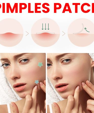 Jaysuing Star Colored Acne Stickers Repair Acne Pits & Marks Fade Acne Spots Blemishes Cover Acne Pimples