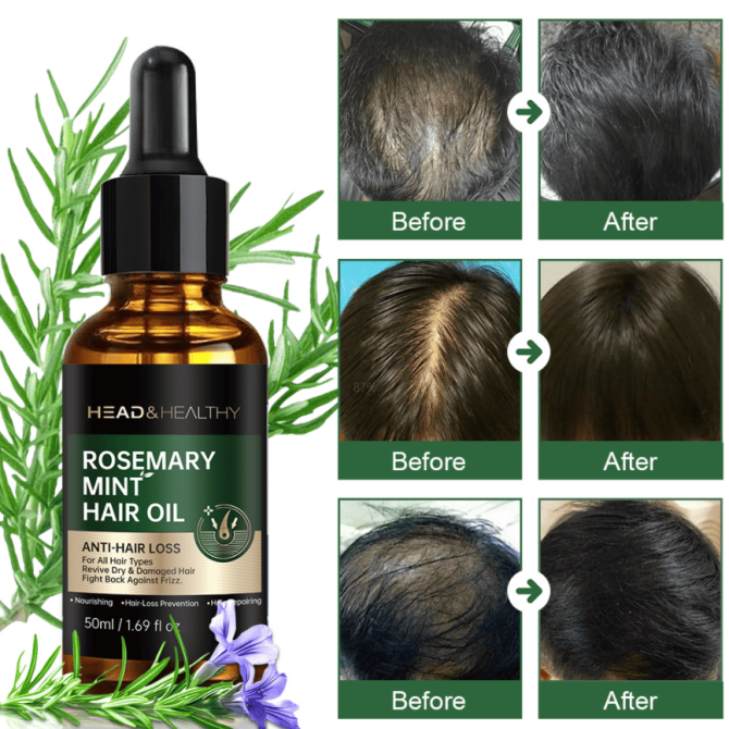 PSA04   rosemary mint hair care essential oil, fast and best hair oil, rosemary oil, organic hair growth, hair growth essence oil, Lissage et lissage Amélioration de la brillance Lissage et lissage, - Image 11