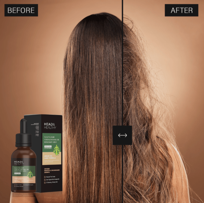 PSA04   rosemary mint hair care essential oil, fast and best hair oil, rosemary oil, organic hair growth, hair growth essence oil, Lissage et lissage Amélioration de la brillance Lissage et lissage, - Image 5