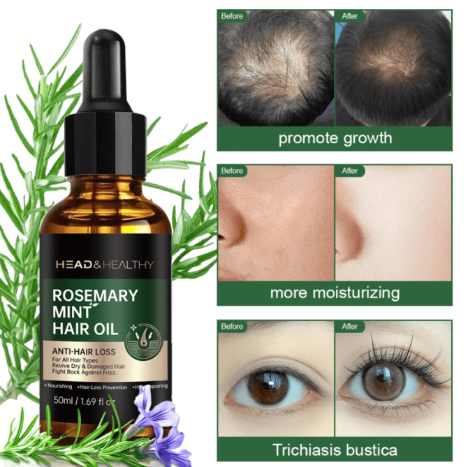 PSA04   rosemary mint hair care essential oil, fast and best hair oil, rosemary oil, organic hair growth, hair growth essence oil, Lissage et lissage Amélioration de la brillance Lissage et lissage, - Image 10