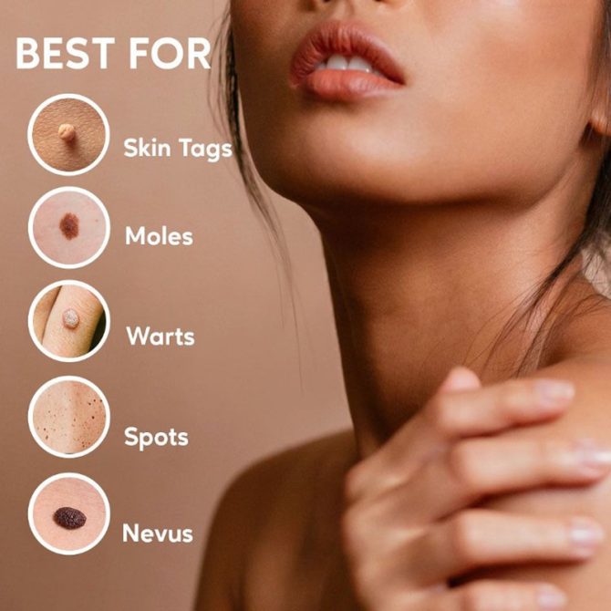 Wart Spot Nevus Remover Cream Painless Mole Dark Spot Warts Remover Serum Freckle Face Wart Tag Treatment Removal Essential Oil - Image 8