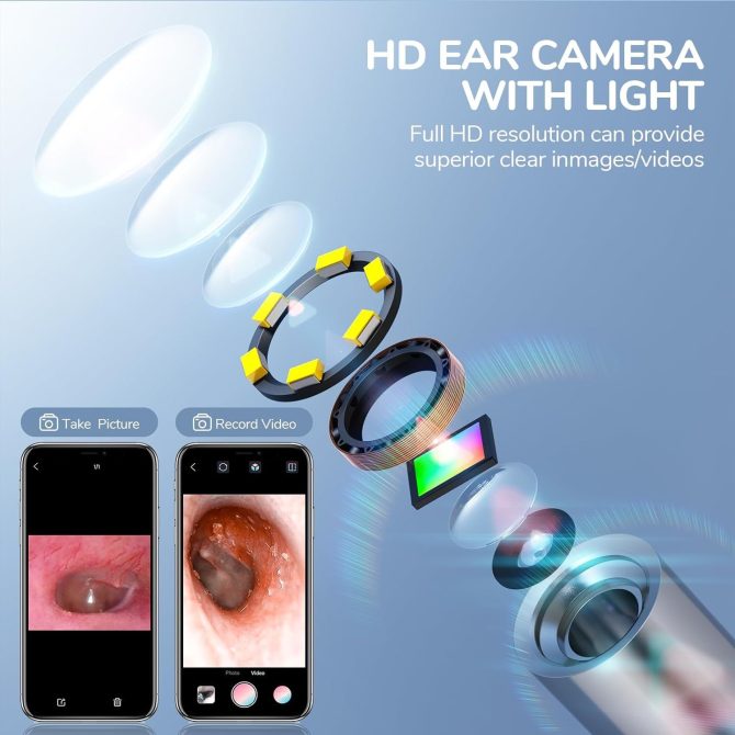 Digital Otoscope with Ear Wax Removal Tool - Image 3
