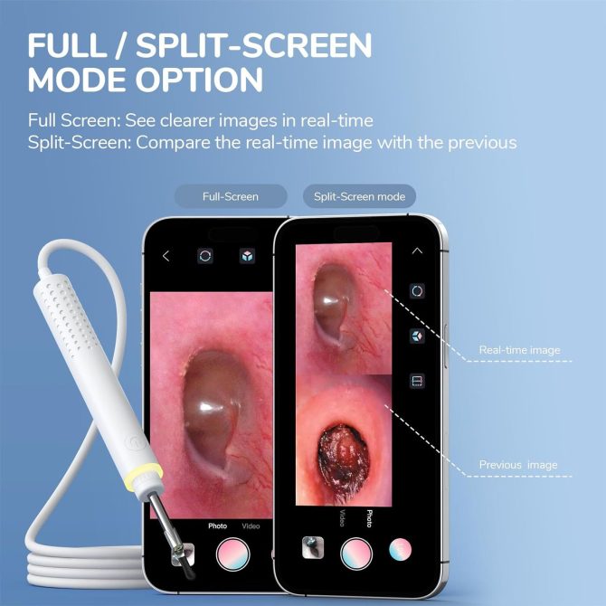 Digital Otoscope with Ear Wax Removal Tool - Image 6