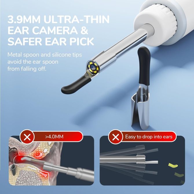 Digital Otoscope with Ear Wax Removal Tool - Image 7
