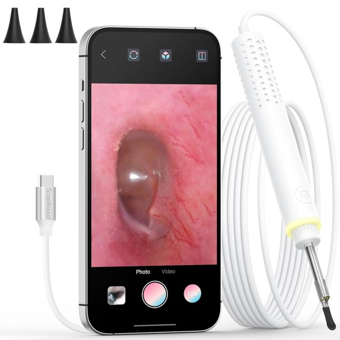 Digital Otoscope with Ear Wax Removal Tool - Image 2