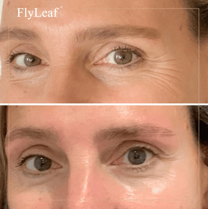 PSKA1015  Caffeine Eye Cream Vitamin C Eye Cream Capacity 55g*2 Sell 1*2pc dark circles, facial swelling, facial wrinkles and fine lines, caffeine eye cream contains hyaluronic acid, vitamin E, vitam - Image 7