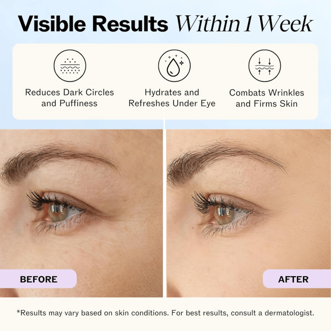 PSKA1015  Caffeine Eye Cream Vitamin C Eye Cream Capacity 55g*2 Sell 1*2pc dark circles, facial swelling, facial wrinkles and fine lines, caffeine eye cream contains hyaluronic acid, vitamin E, vitam - Image 8
