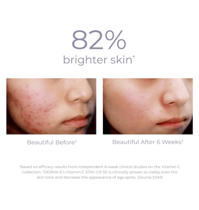 PSKB1016 Vitamin C Concentrated E Anti-Aging Regeneration Essence Day and Night Moisturizing Esence Contains Ethanol Acid and Vitamin A, Advanced Facial Skin Care Capacity 60ml*2 Sales Set 1*2pc Skin - Image 8