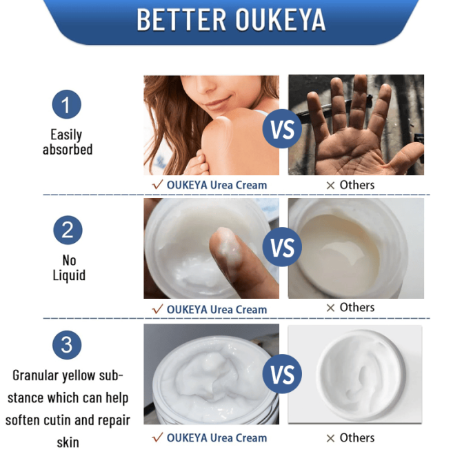 PSKA1113  Hand Cream Foot and Hand Urea Cream Capacity 150g*2 Sales 1*2pc Vitamin E Dry cracked urea lotion, hydrating, moisturizing, firming and anti-wrinkle, reducing the accumulation of corns and - Image 6