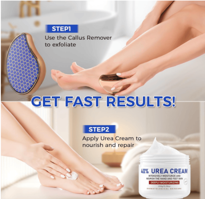 PSKA1113  Hand Cream Foot and Hand Urea Cream Capacity 150g*2 Sales 1*2pc Vitamin E Dry cracked urea lotion, hydrating, moisturizing, firming and anti-wrinkle, reducing the accumulation of corns and - Image 7