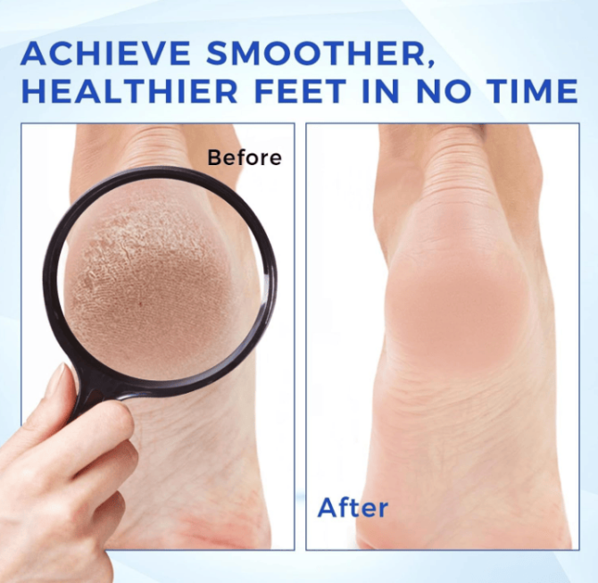 PSKA1113  Hand Cream Foot and Hand Urea Cream Capacity 150g*2 Sales 1*2pc Vitamin E Dry cracked urea lotion, hydrating, moisturizing, firming and anti-wrinkle, reducing the accumulation of corns and - Image 8