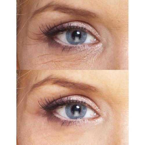 Ageless Beauty: Eye Repair Cream + Antioxidant Serum + Repair Night - Image 5