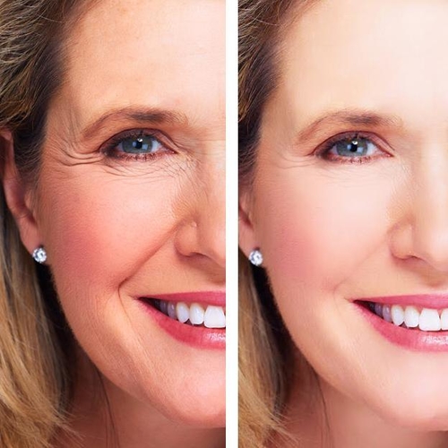 Age Perfect: Night Repair Cream + Vitamin C+ Serum - Image 4