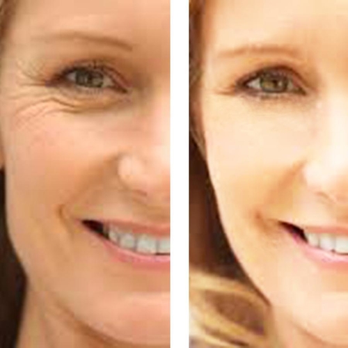 C+ Antioxidant Wrinkle Reduction Serum - Image 4
