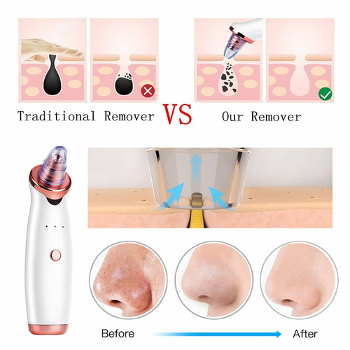 Facial Blackhead Remover Electric Vacuum Machine - Image 9